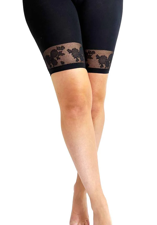 Floral Lace Trim | COMFORT SHORTS - Image 2